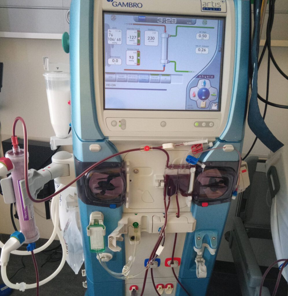 Reguläre Dialysemaschine